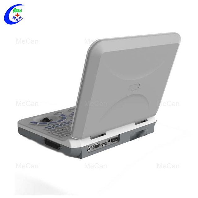 &Eacute;chographie sur ordinateur portable – Portable et efficace