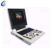 Warna Doppler Ultrasound - f&eacute;tal Imaging