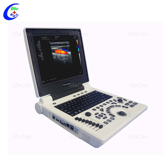 USG Doppler Warna - Pencitraan Janin