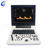 Warna Doppler Ultrasound - f&eacute;tal Imaging