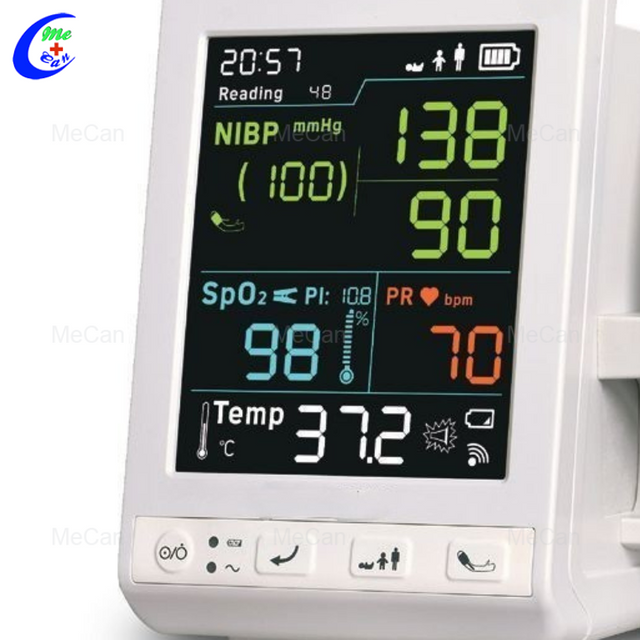 Advanced na Vital Signs Monitor: Tumpak na Solusyon sa Pagsubaybay sa Kalusugan
