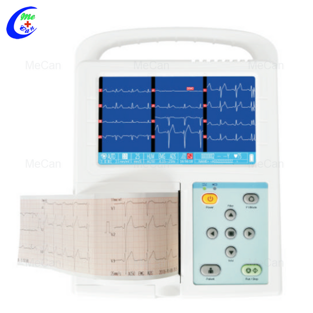 So ECG: Precise Heart Health Diagnosis & Monitoring