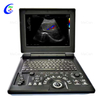 Full Digital Color Doppler Diagnostic System