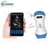 Sganiwr Uwchsain Math Probe Wireless WiFi