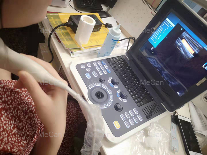klijent juża dan il-Mudell tal-Magni Ultrasound Doppler tal-Kulur: MCI0512