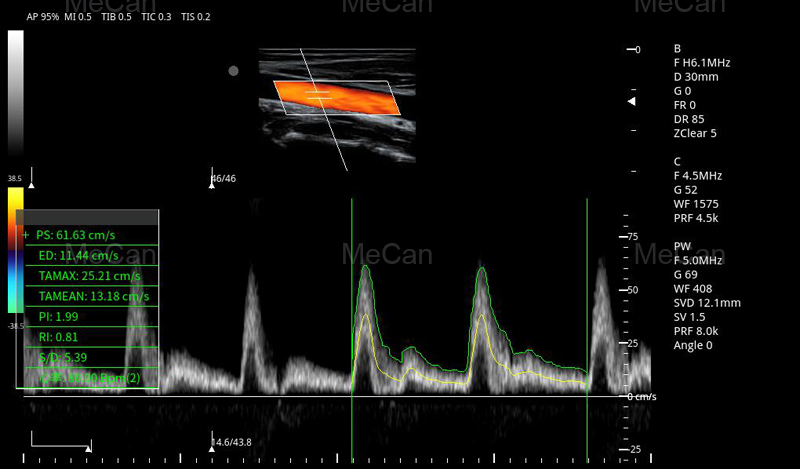 tlhahlobo ea litšoantšo ea Boitsebiso bo eketsehileng ba 4D Ultrasound Machine-1