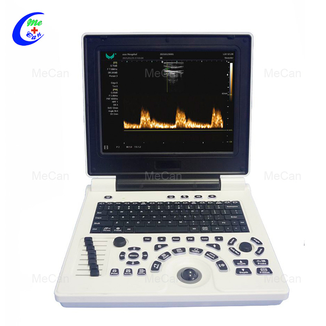 Sistem Diagnostik Doppler Warna Digital Penuh