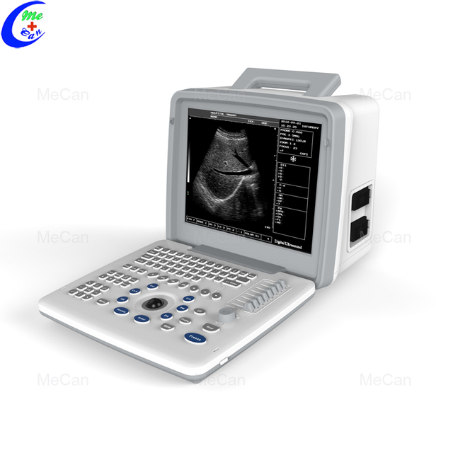 Cel mai bun scaner medical portabil cu ultrasunete Companie de aparate cu ultrasunete B/N - MeCan Medical
