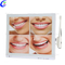 China Dental Nuevo modelo de c&aacute;mara intraoral de 2 megap&iacute;xeles con fabricantes de monitores - MeCan Medical