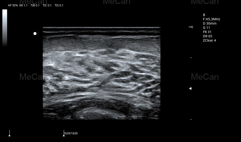 test imaging of More information of 4D Ultrasound Machine-2