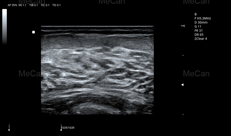 test billeddannelse af Mere information om 4D Ultrasound Machine-2