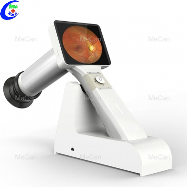 Professjonali Oftalmiċi Handheld Portable Digital Eye Exam Fundus Camera manifatturi