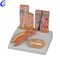 China Human Skin Anatomy Model manufacturers - MeCan Medical