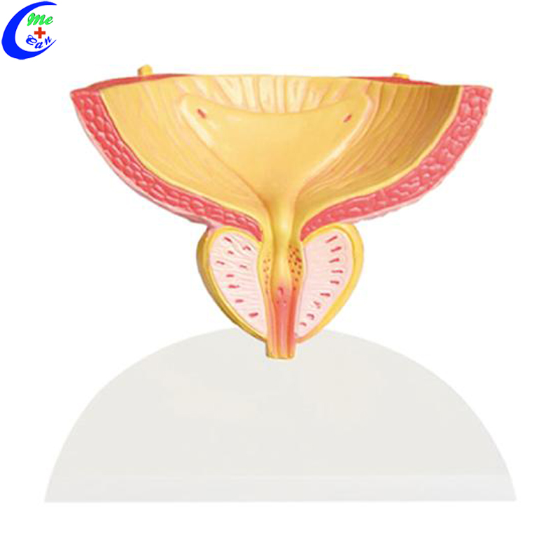 prostate anatomical model .jpg