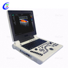 Full Digital Color Doppler Diagnostic System