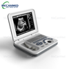 Scanner Ultrasound Portable | Mesin Ultrasound Digital Kab
