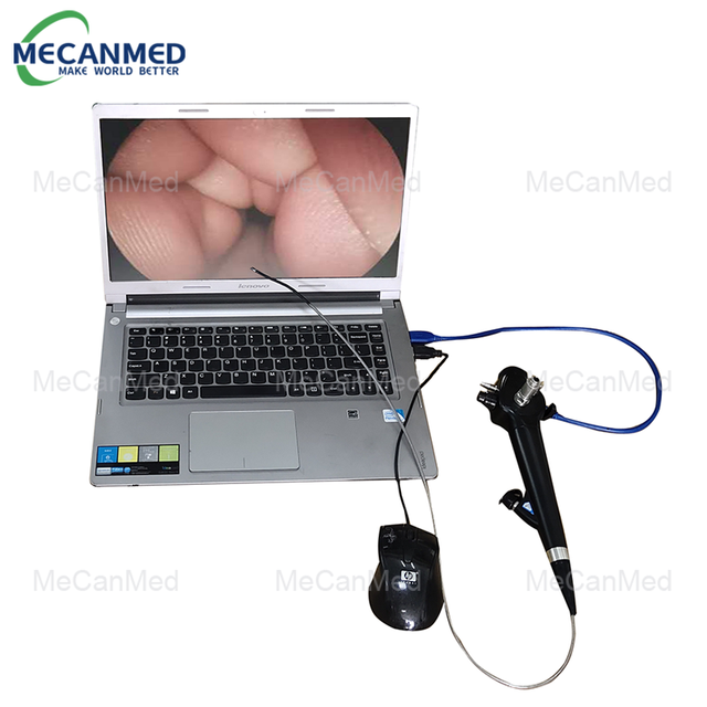 पोर्टेबल USB Nasopharyngoscope