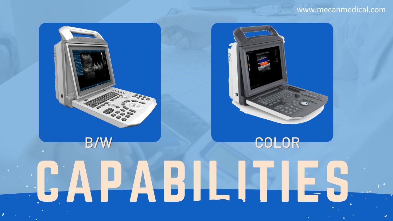 흑백 초음파 및 컬러 도플러