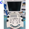 Melhor carrinho de m&aacute;quina de ultrassom B/W m&eacute;dico hospitalar Empresa de m&aacute;quinas de scanner de ultrassom digital m&oacute;vel - MeCan Medical