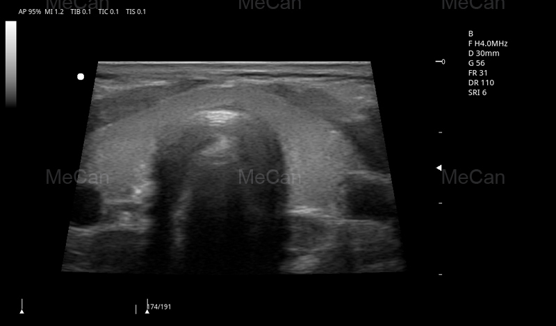 tlhahlobo ea litšoantšo ea Boitsebiso bo eketsehileng ba 4D Ultrasound Machine-4