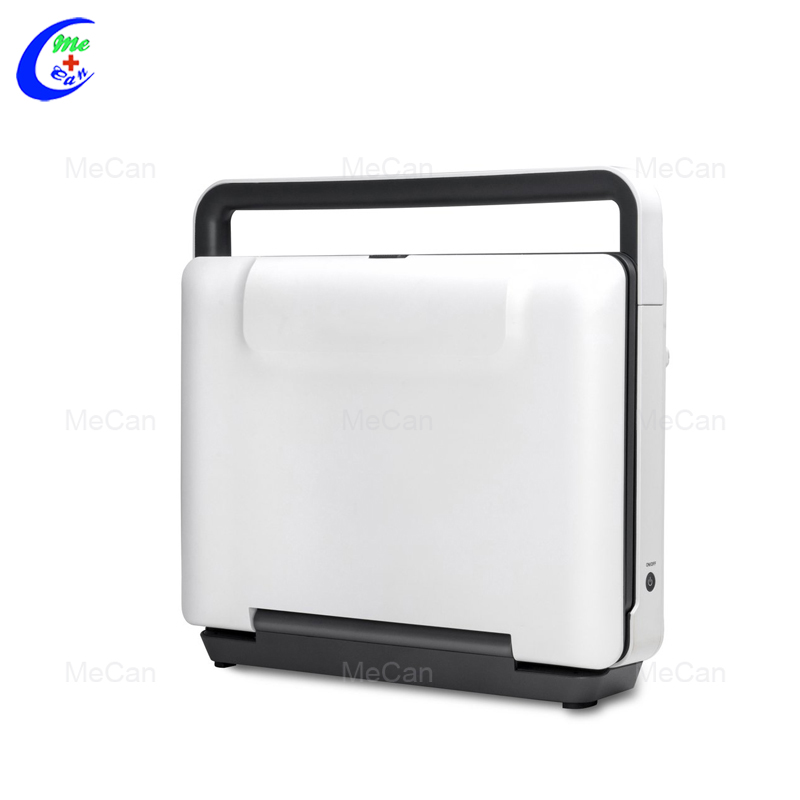 Quality Medical Portable Ultrasound Machine Sonoscape E1 BW Ultrasound Scanner Manufacturer | MeCan Medical