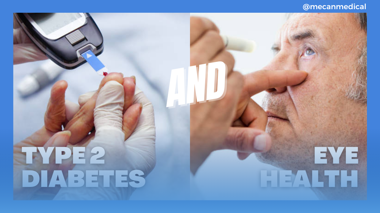סוכרת סוג 2 והשפעתה על בריאות העיניים