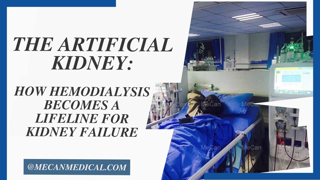 Ang Artipisyal nga Kidney: Giunsa Ang Hemodialysis Nahimong Linya sa Kinabuhi alang sa Pagkapakyas sa Bato
