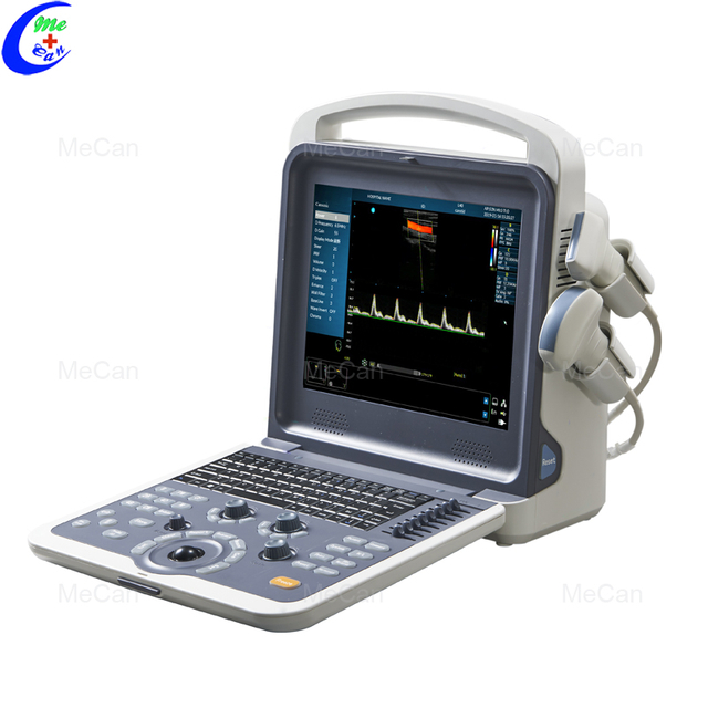 Качествен производител на цветен доплер ултразвуков апарат | MeCan Medical