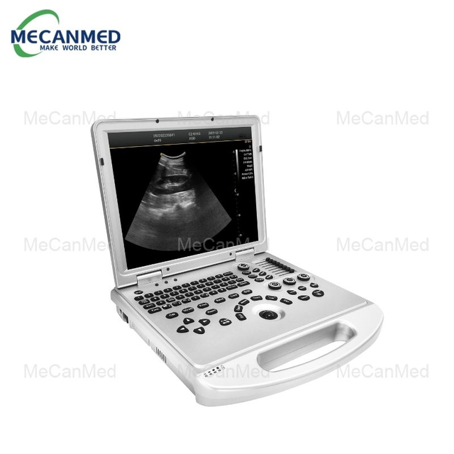 Sistem digital portabil de ultrasunete Doppler color