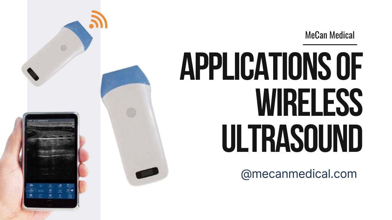 Ke ʻimi nei i nā mea hoʻohana o ke kani kani uila