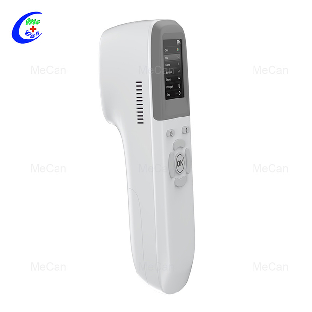 Omwe adapeza, owonjezera vein