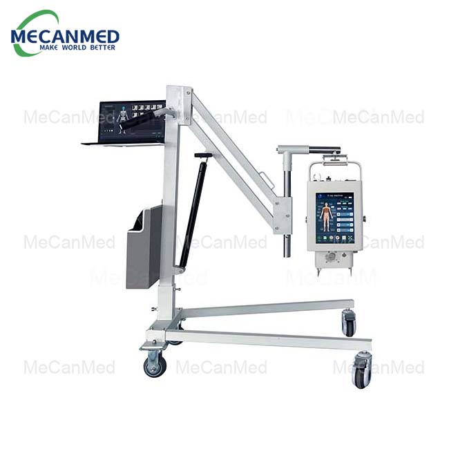 ایکس رے کا حقیقی دنیا کا استعمال۔