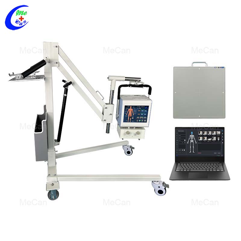 High Quality 5KW Digital Portable X-ray Unit Wholesale-Guangzhou MeCan Medical Limited