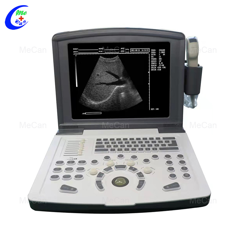 Quality B/W Ultrasound Machine, Full Digital Ultrasound Scanner Manufacturer | MeCan Medical