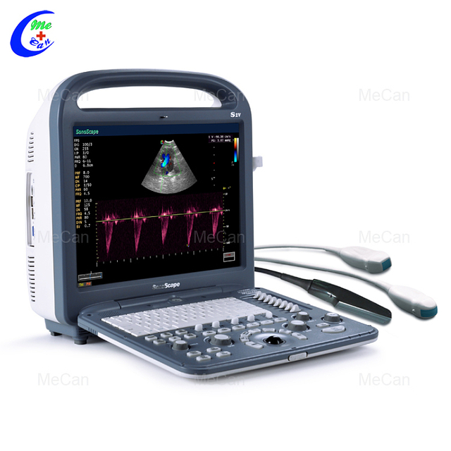 హోల్‌సేల్ వెట్ పోర్టబుల్ అల్ట్రాసౌండ్ స్కానర్ యానిమల్ వెటర్నరీ పోర్టబుల్ కలర్ డాప్లర్ అల్ట్రాసౌండ్ మెషిన్ సోనోస్కేప్ S2V మంచి ధరతో - MeCan మెడికల్