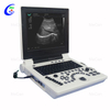 Full Digital Color Doppler Diagnostic System