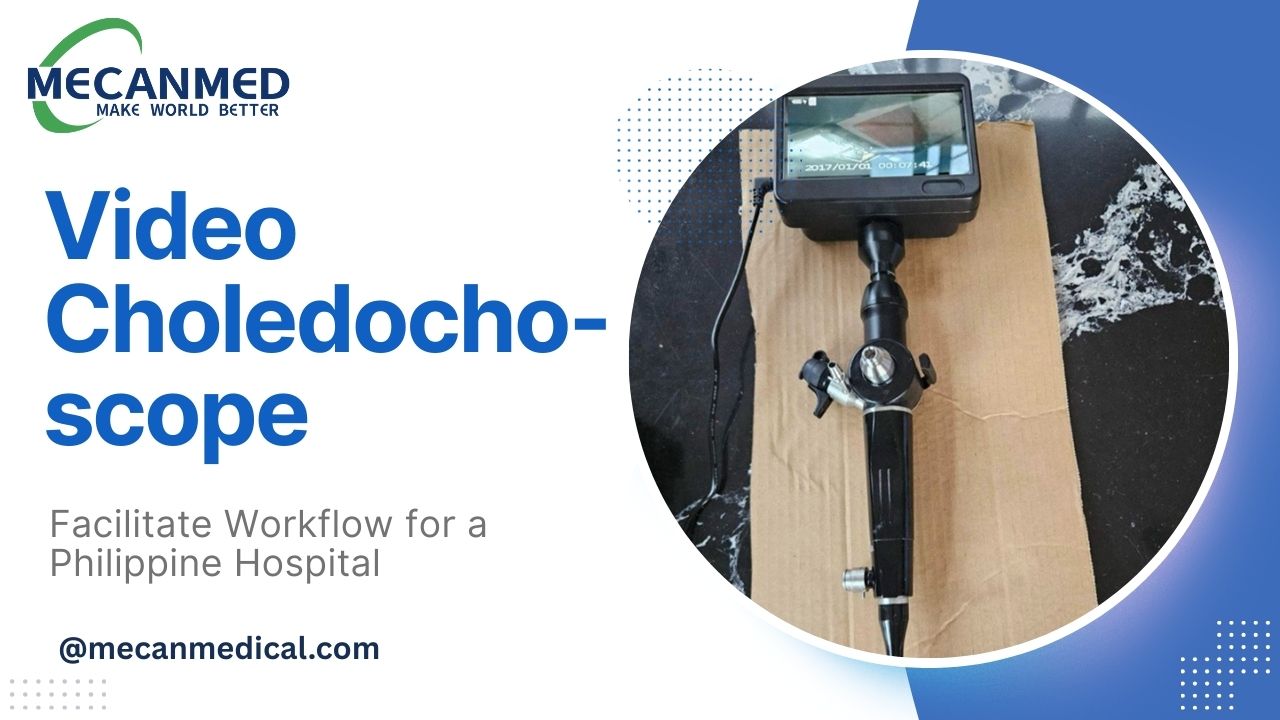 Video Choledochoscope para sa Ospital sa Pilipinas: Pagpadali sa Trabaho