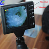 Pinakamahusay na Portable Fiber Optic ENT Endoscope, Flexible Endoscope ENT Company - MeCan Medical