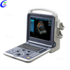 Quality Color Doppler Ultrasound Machine Manufacturer | MeCan Medical
