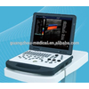 3D Laptọọpụ Doppler Agba Ultrasound Scanner