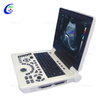 Full Digital Color Doppler Diagnostic System