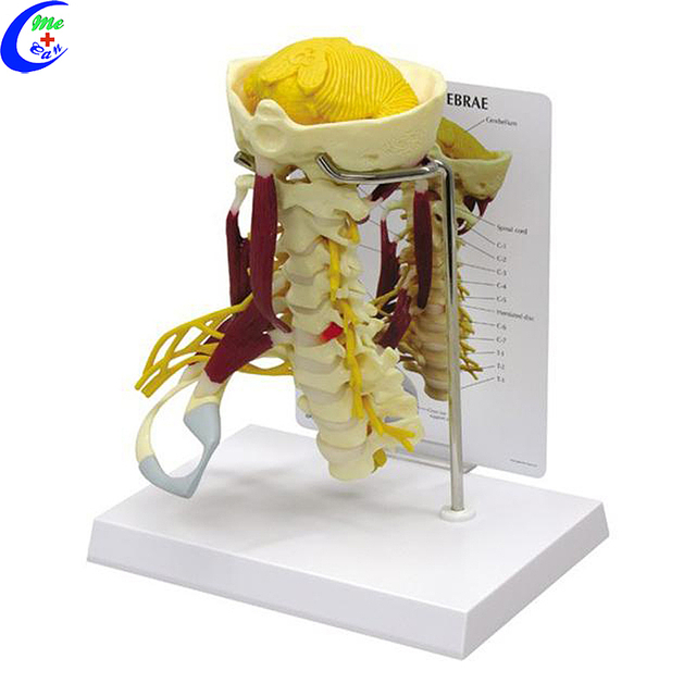 Hochwertiges 3D-Modell der menschlichen Anatomie der Wirbels&auml;ule im Gro&szlig;handel - Guangzhou MeCan Medical Limited