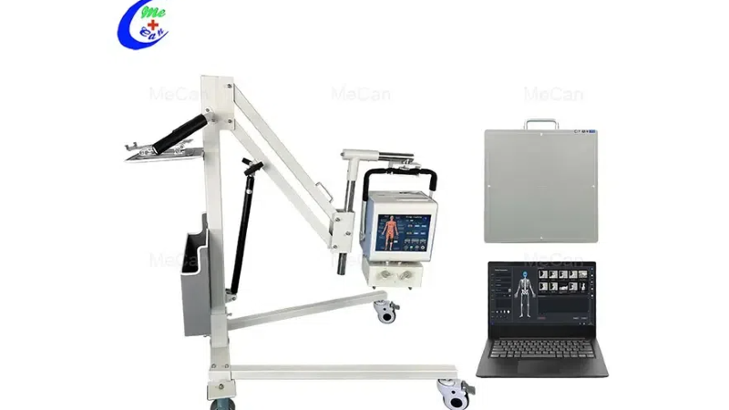 Rivoluzionare la diagnostica: come le macchine a raggi X digitali stanno trasformando l'assistenza sanitaria moderna