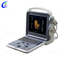 Ποιοτικό φορητό Full Digital Color Doppler Diagnostic Scanner Υπερήχων Κατασκευαστής | MeCan Medical