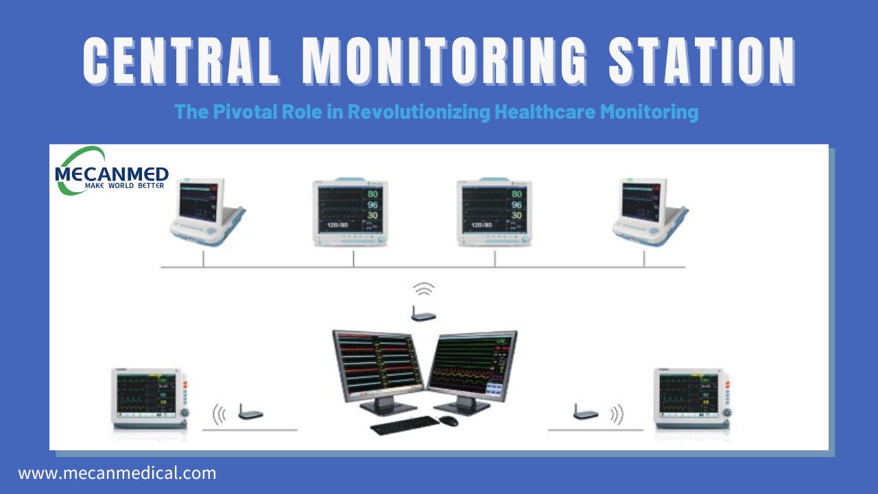 중앙 모니터링 스테이션: 의료 모니터링 혁명의 중추적인 역할