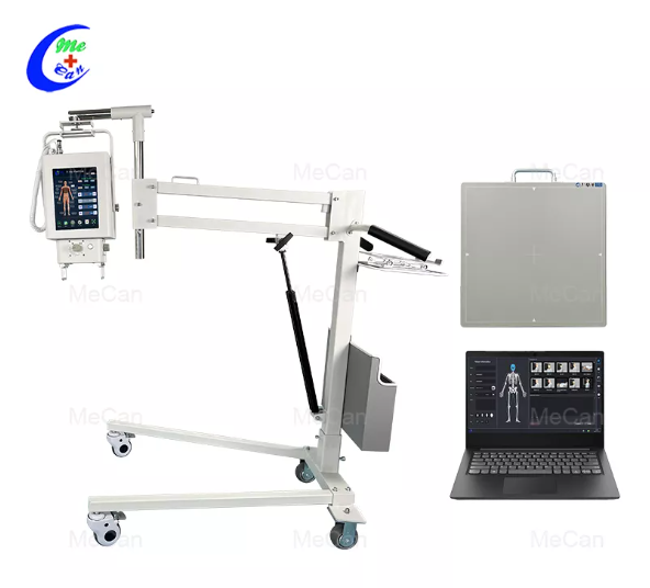Quanto costa un sistema radiografico portatile?