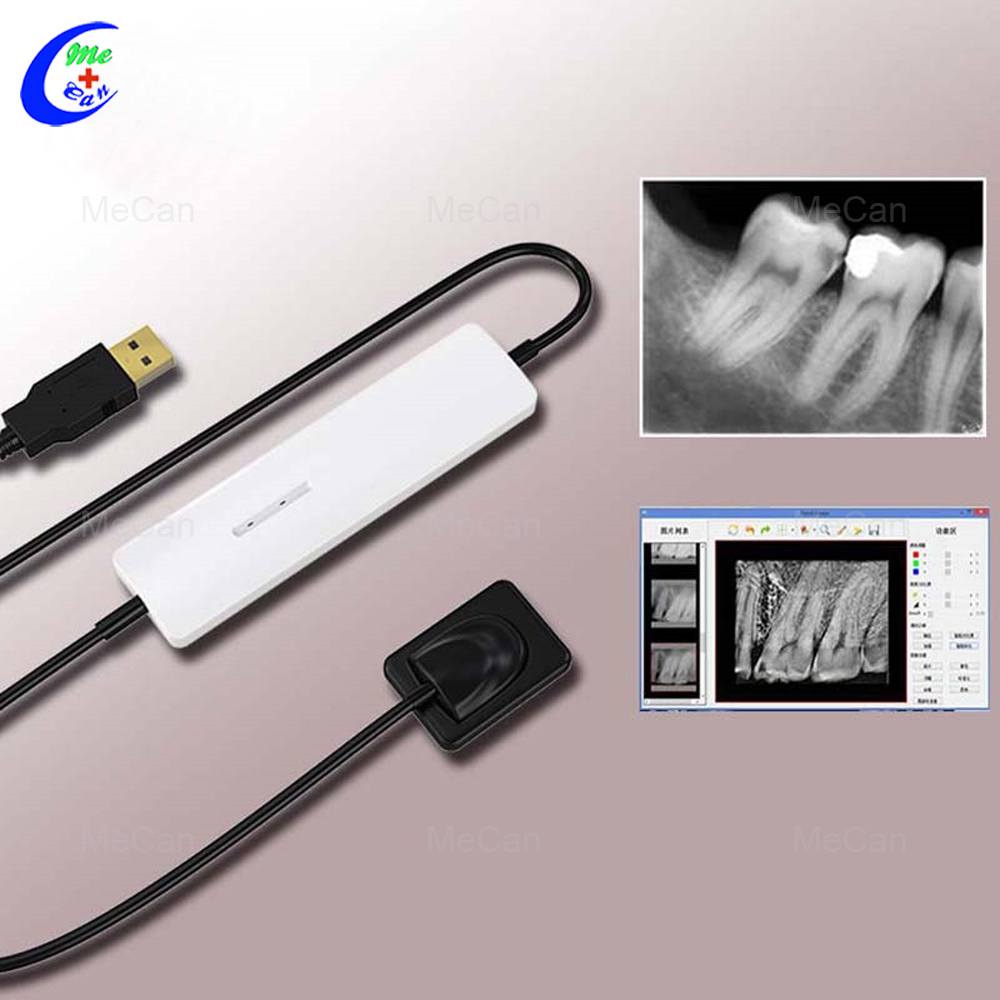 Professional Digital Intraoral Sensor System for Dental X-Ray Unit Manufacturers
