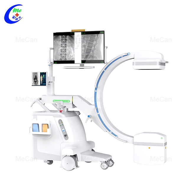 ఆపరేషన్ తయారీదారుల కోసం ప్రొఫెషనల్ ఎక్స్-రే సిస్టమ్ సి-ఆర్మ్ ఎక్స్ రే మెషిన్