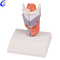 Alat Bantu Mengajar Anatomi Perubatan China Pengeluar Model Larynx - MeCan Medical