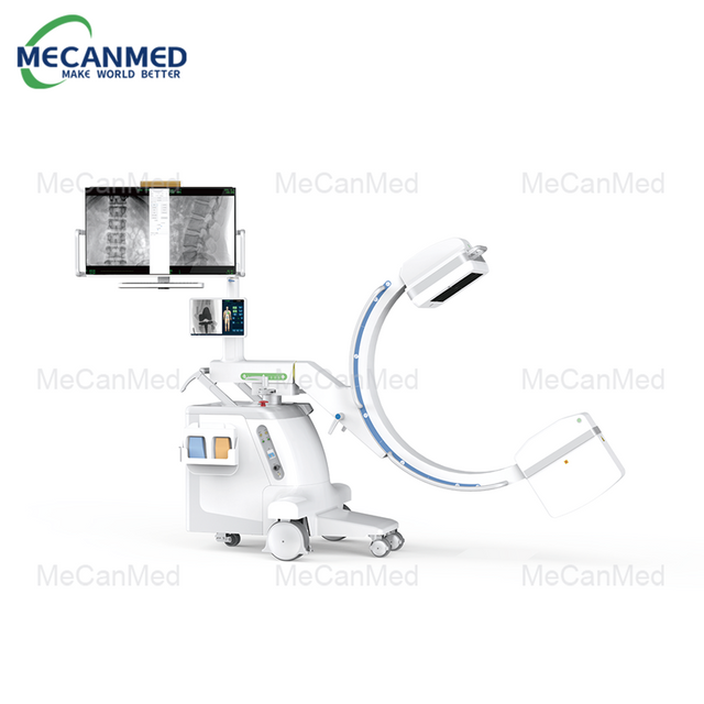 ระบบ C-arm จอแบนแบบไดนามิกเคลื่อนที่